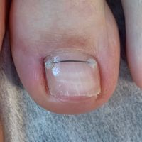FLAKON.BEAUTY — скульптурный массаж лица