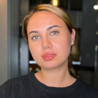 Кенжаева Яна — rf-лифтинг в городе Псков