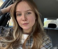 Юлия К — rf-лифтинг в Воронеже