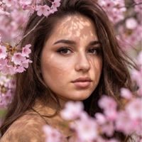 Вера — биоревитализация в Зеленограде