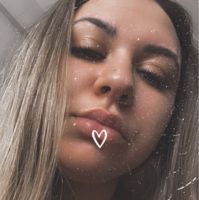 Анна Резванова — контурная пластика (филлеры Neocoll/Repart) в Красноярске
