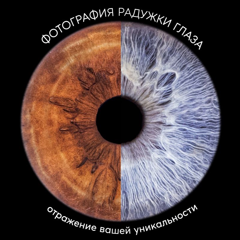 Фото радужки глаза