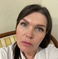 Инна — удаление татуировки в Рязани