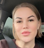 Елена Немченкова — пилинг кожи головы во Владимире