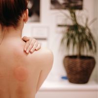 Студия массажа #станьлучше — пилинг в Северодвинске