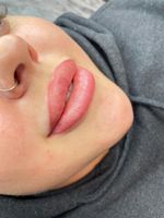 Grand Prix for eyes м. Технологический институт — LPG массаж