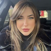 Наталия — удаление татуировки в Воронеже
