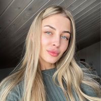 Виктория — rf-лифтинг в Твери